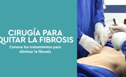 CirugÃ­a para quitar fibrosis - Conoce los tratamientos para eliminar la fibrosis