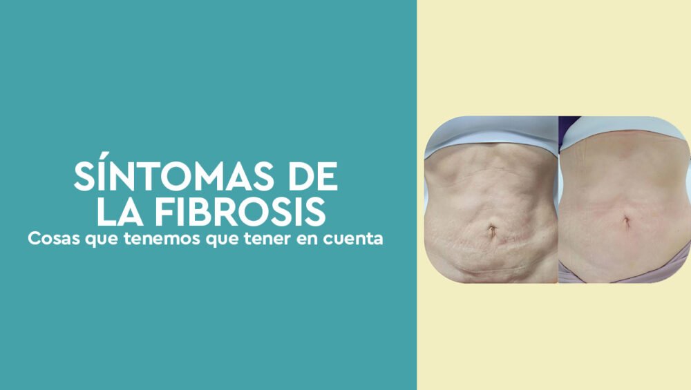 Síntomas de la fibrosis - Cosas a tener en cuenta