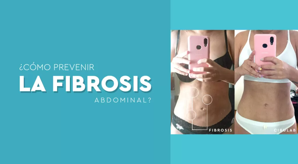 Como prevenir la fibrosis abdominal